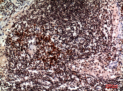 CD244 Rabbit Polyclonal Antibody | 兔多抗 | EnkiLife恩玑生命