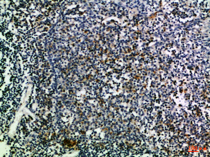 CD274 Rabbit Polyclonal Antibody | 兔多抗 | EnkiLife恩玑生命