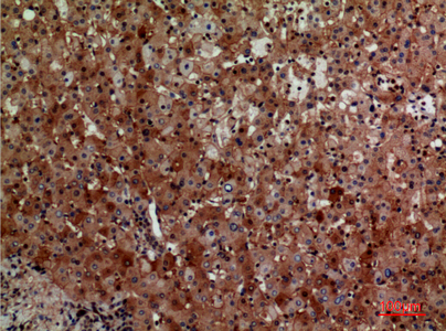 CD276 Rabbit Polyclonal Antibody | 兔多抗 | EnkiLife恩玑生命