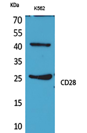 CD28 Rabbit Polyclonal Antibody | 兔多抗 | EnkiLife恩玑生命