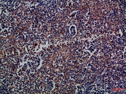 CD300a Rabbit Polyclonal Antibody | 兔多抗 | EnkiLife恩玑生命