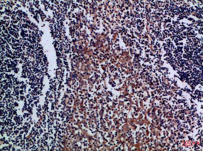 CD300a Rabbit Polyclonal Antibody | 兔多抗 | EnkiLife恩玑生命