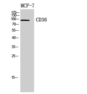 CD36 Rabbit Polyclonal Antibody | 兔多抗 | EnkiLife恩玑生命