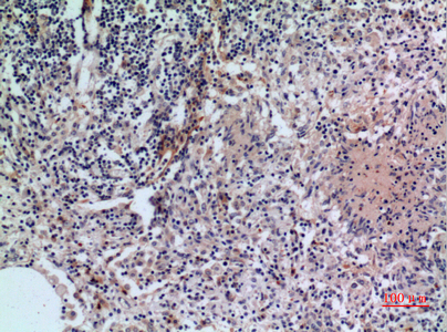 CD38 Rabbit Polyclonal Antibody | 兔多抗 | EnkiLife恩玑生命