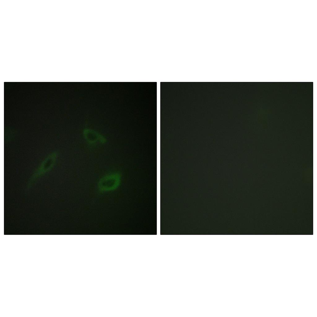 CD4 Rabbit Polyclonal Antibody | 兔多抗 | EnkiLife恩玑生命