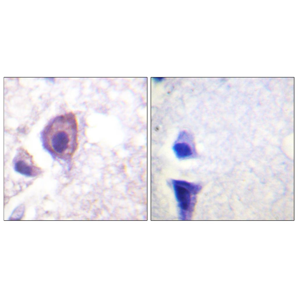 CD4 Rabbit Polyclonal Antibody | 兔多抗 | EnkiLife恩玑生命