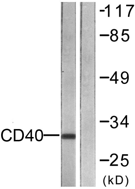 CD40 Rabbit Polyclonal Antibody | 兔多抗 | EnkiLife恩玑生命