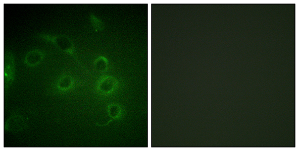 CD45 Rabbit Polyclonal Antibody | 兔多抗 | EnkiLife恩玑生命