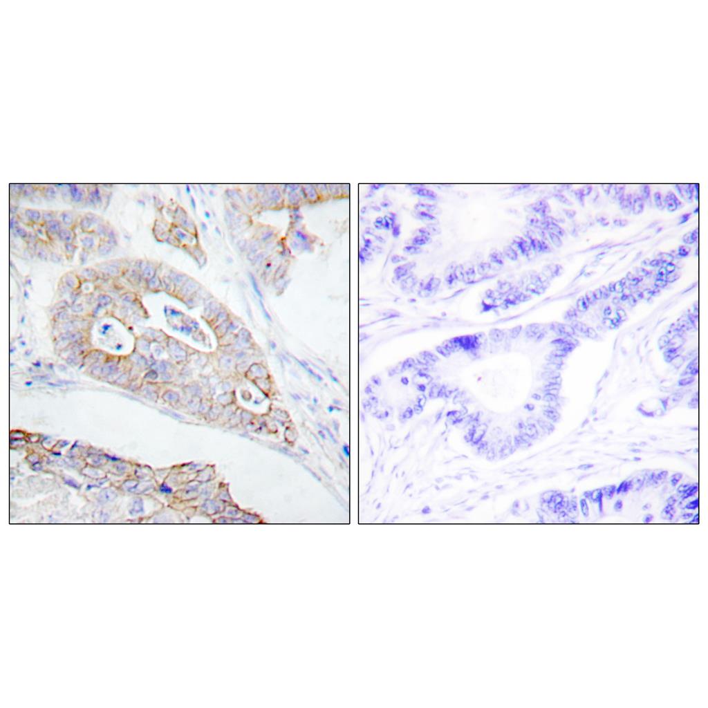 CD45 Rabbit Polyclonal Antibody | 兔多抗 | EnkiLife恩玑生命