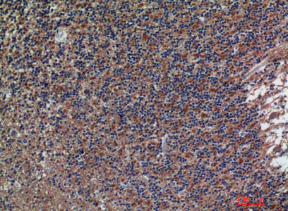 CD56 Rabbit Polyclonal Antibody | 兔多抗 | EnkiLife恩玑生命