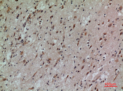 CD58 Rabbit Polyclonal Antibody | 兔多抗 | EnkiLife恩玑生命