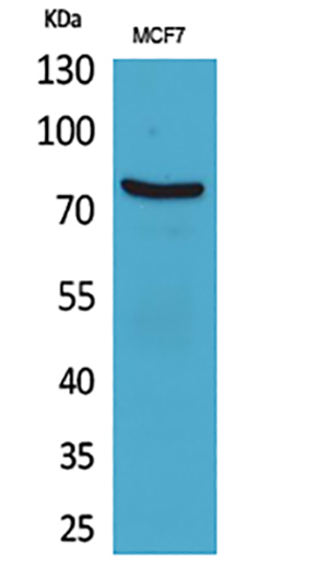 CD66e Rabbit Polyclonal Antibody | 兔多抗 | EnkiLife恩玑生命