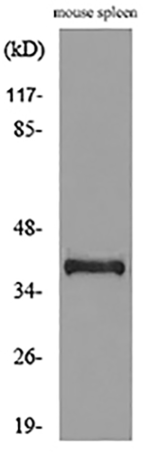 CD68 Rabbit Polyclonal Antibody | 兔多抗 | EnkiLife恩玑生命