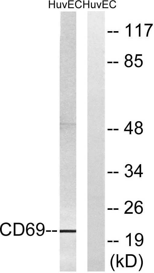 CD69 Rabbit Polyclonal Antibody | 兔多抗 | EnkiLife恩玑生命