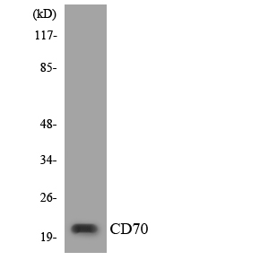 CD70 Rabbit Polyclonal Antibody | 兔多抗 | EnkiLife恩玑生命