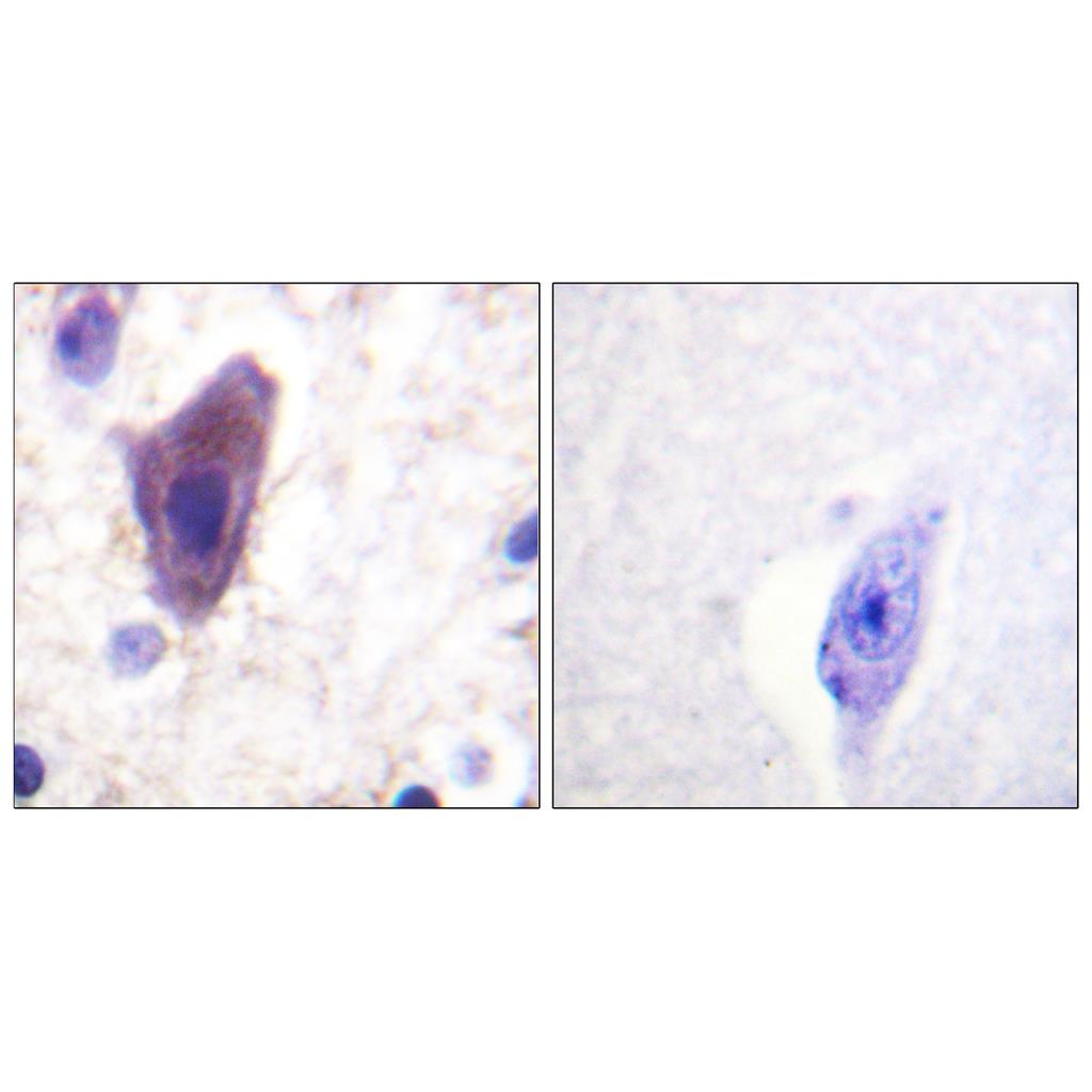 CD71 Rabbit Polyclonal Antibody | 兔多抗 | EnkiLife恩玑生命