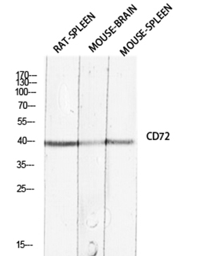 CD72 Rabbit Polyclonal Antibody | 兔多抗 | EnkiLife恩玑生命
