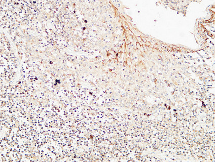 CD72 Rabbit Polyclonal Antibody | 兔多抗 | EnkiLife恩玑生命