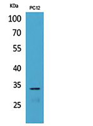 CD74 Rabbit Polyclonal Antibody | 兔多抗 | EnkiLife恩玑生命