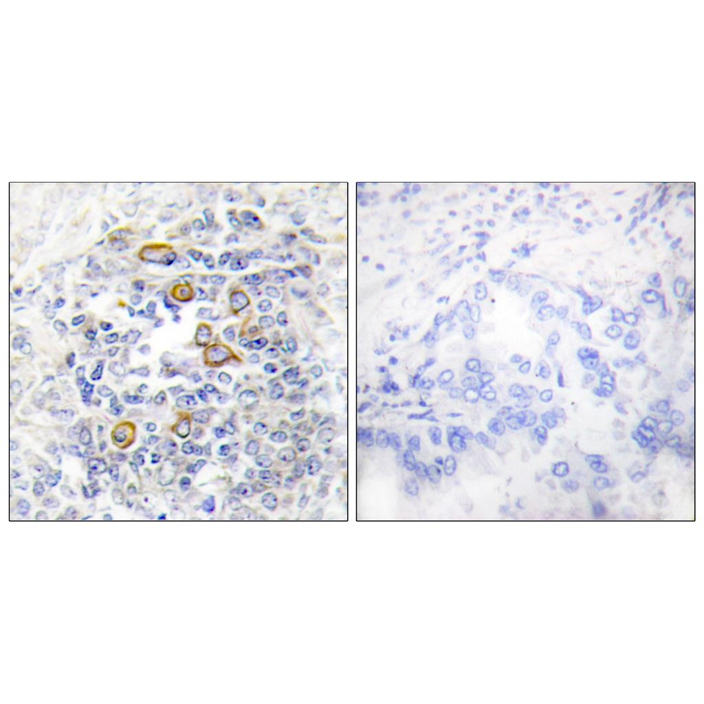 CD83 Rabbit Polyclonal Antibody | 兔多抗 | EnkiLife恩玑生命