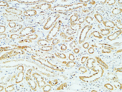 CD83 Rabbit Polyclonal Antibody | 兔多抗 | EnkiLife恩玑生命