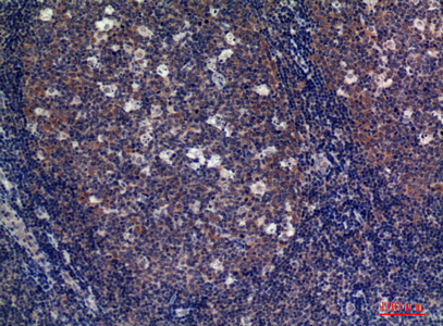 CD89 Rabbit Polyclonal Antibody | 兔多抗 | EnkiLife恩玑生命