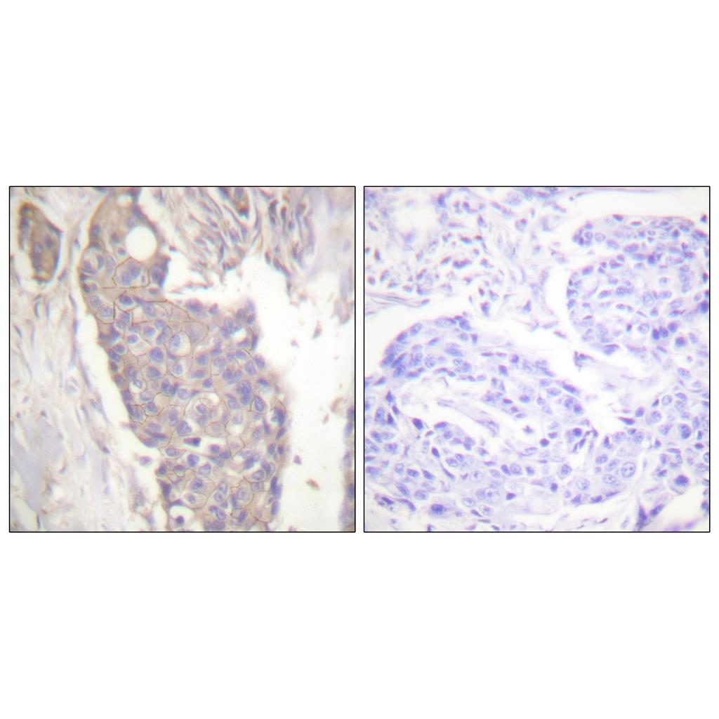 CD95 Rabbit Polyclonal Antibody | 兔多抗 | EnkiLife恩玑生命