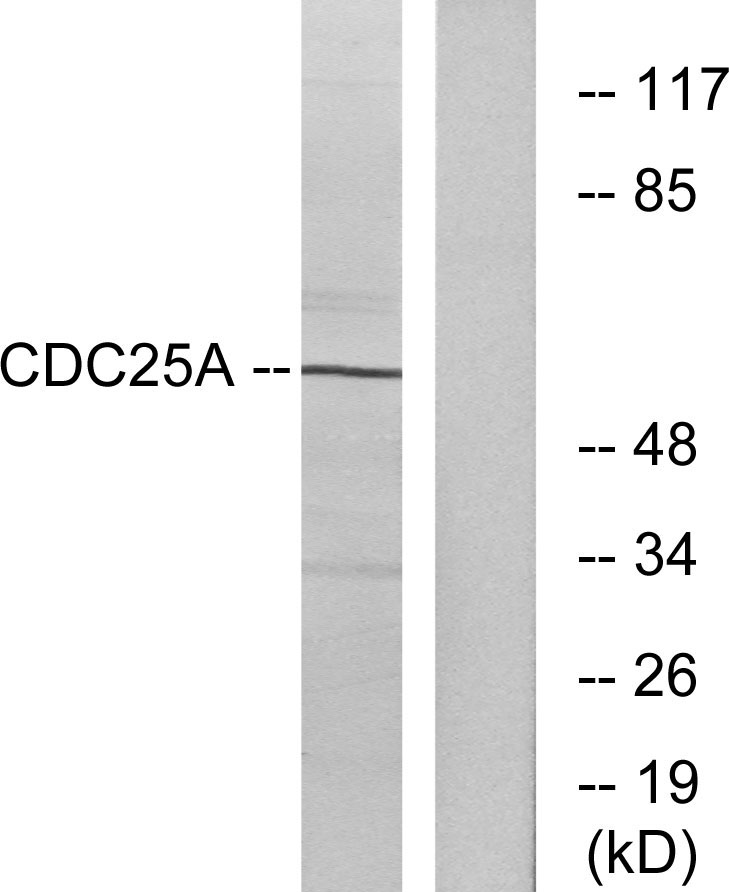 Cdc25A Rabbit Polyclonal Antibody | 兔多抗 | EnkiLife恩玑生命