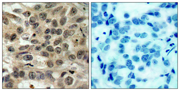 Cdc25C Rabbit Polyclonal Antibody | 兔多抗 | EnkiLife恩玑生命