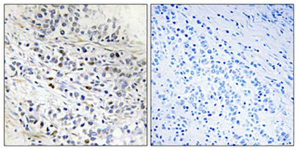 Cdc7 Rabbit Polyclonal Antibody | 兔多抗 | EnkiLife恩玑生命