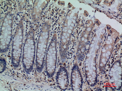 CDCP1 Rabbit Polyclonal Antibody | 兔多抗 | EnkiLife恩玑生命