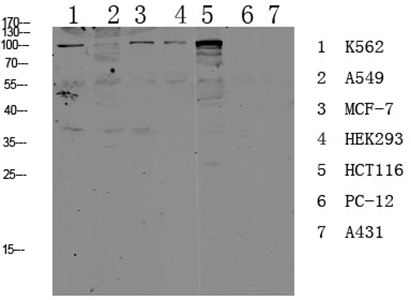 CDH17 Rabbit Polyclonal Antibody | 兔多抗 | EnkiLife恩玑生命