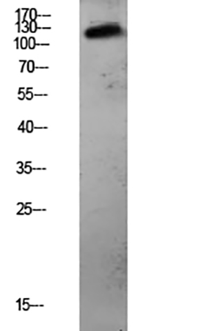 CDH3 Rabbit Polyclonal Antibody | 兔多抗 | EnkiLife恩玑生命