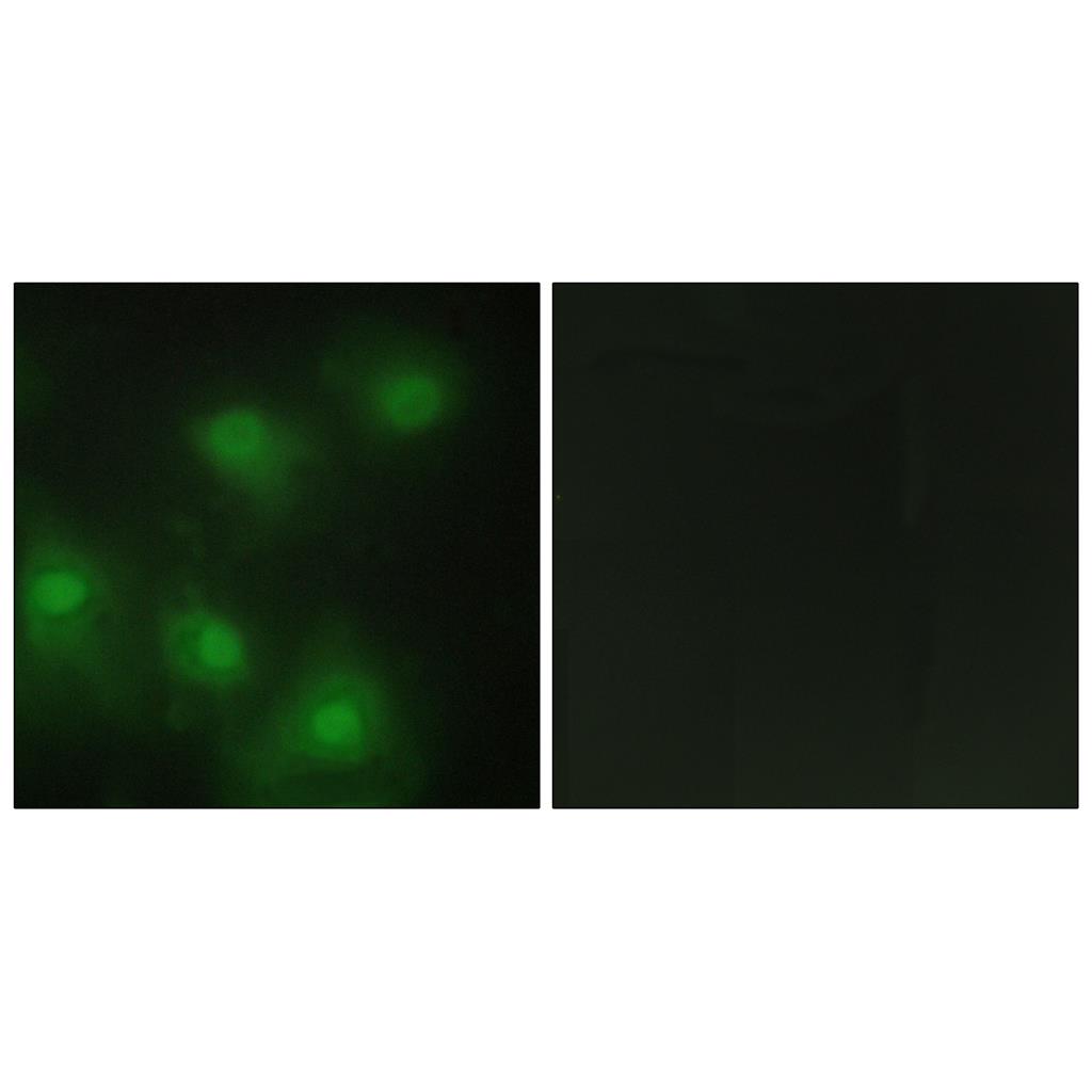 Cdk2 Rabbit Polyclonal Antibody | 兔多抗 | EnkiLife恩玑生命