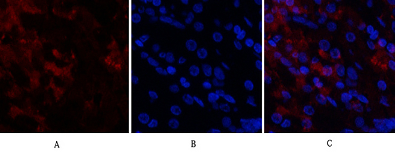Cdk4 Rabbit Polyclonal Antibody | 兔多抗 | EnkiLife恩玑生命