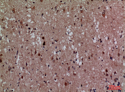 Cdk4 Rabbit Polyclonal Antibody | 兔多抗 | EnkiLife恩玑生命