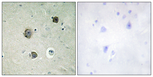 Cdk5 Rabbit Polyclonal Antibody | 兔多抗 | EnkiLife恩玑生命
