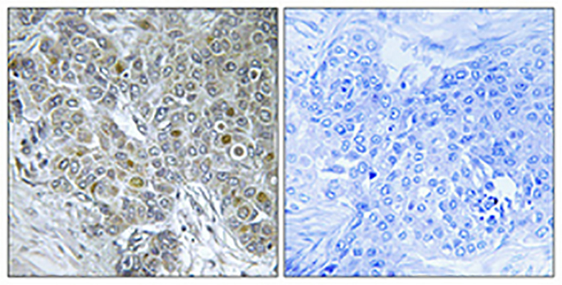 Cdk8 Rabbit Polyclonal Antibody | 兔多抗 | EnkiLife恩玑生命