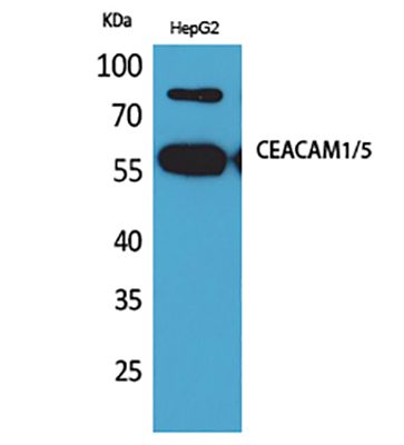 CEACAM1/5 Rabbit Polyclonal Antibody | 兔多抗 | EnkiLife恩玑生命