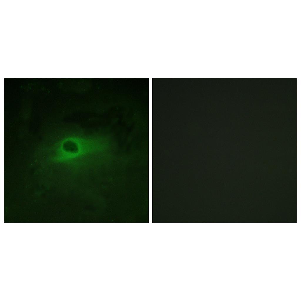 c-Fms Rabbit Polyclonal Antibody | 兔多抗 | EnkiLife恩玑生命