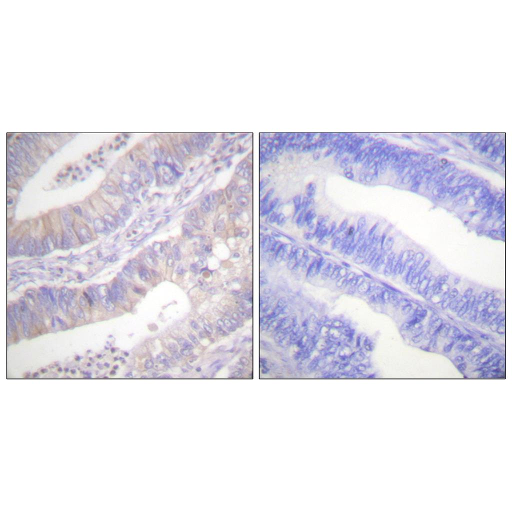 CFTR Rabbit Polyclonal Antibody | 兔多抗 | EnkiLife恩玑生命