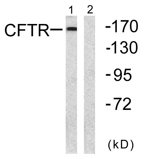 CFTR Rabbit Polyclonal Antibody | 兔多抗 | EnkiLife恩玑生命