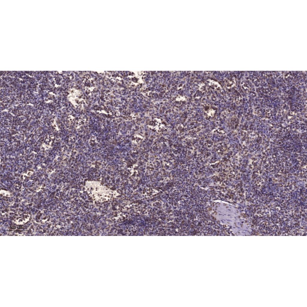 CHD8 Rabbit Polyclonal Antibody | 兔多抗 | EnkiLife恩玑生命