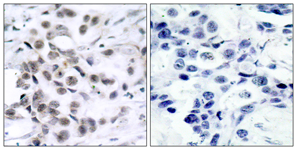 Chk1 Rabbit Polyclonal Antibody | 兔多抗 | EnkiLife恩玑生命