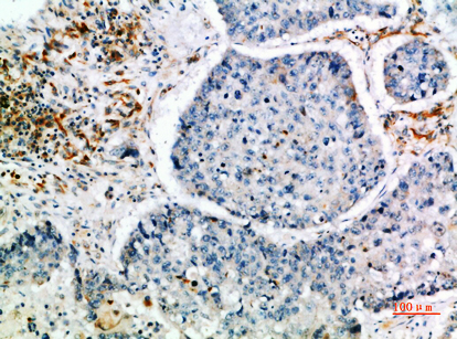 CIS Rabbit Polyclonal Antibody | 兔多抗 | EnkiLife恩玑生命