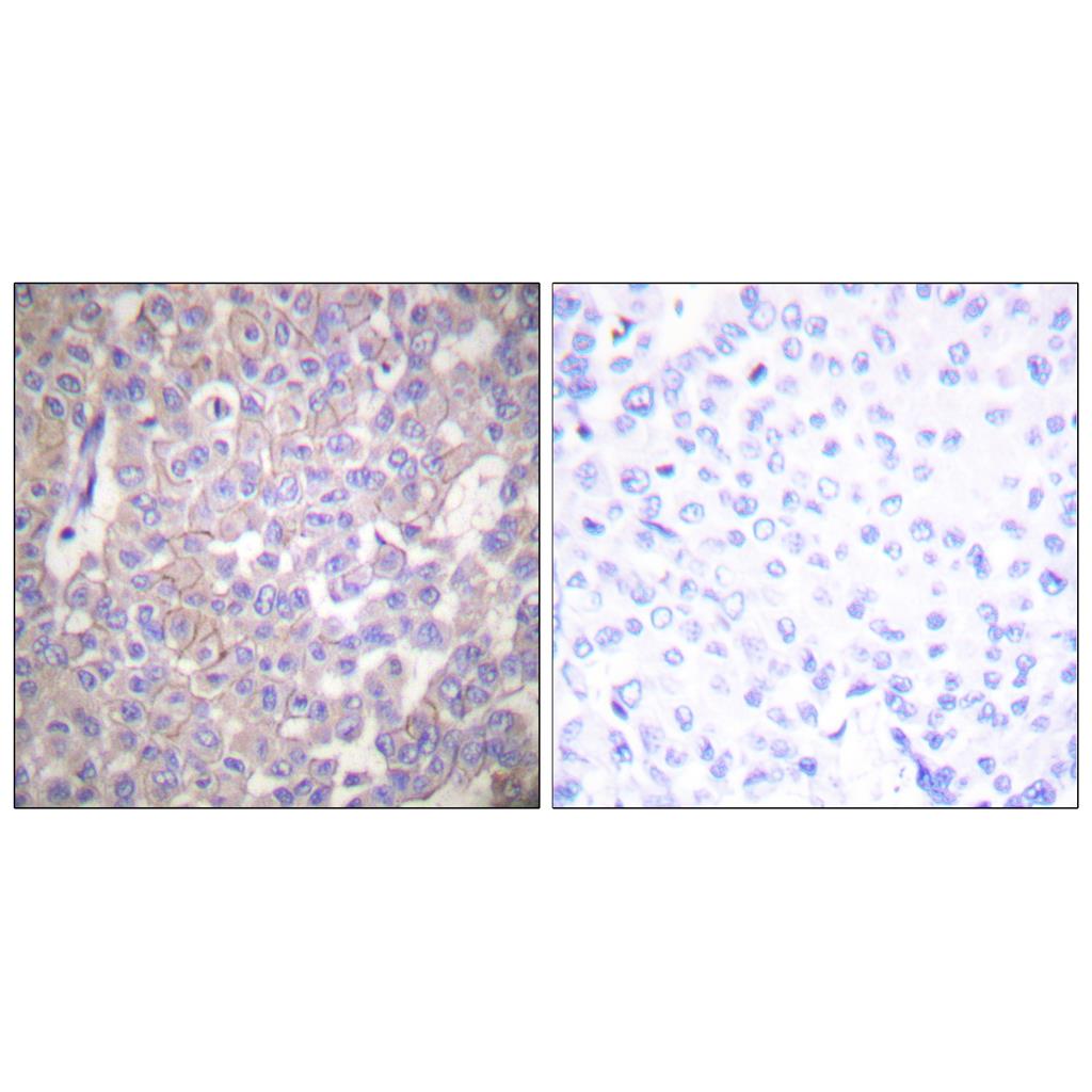 Claudin-2 Rabbit Polyclonal Antibody | 兔多抗 | EnkiLife恩玑生命
