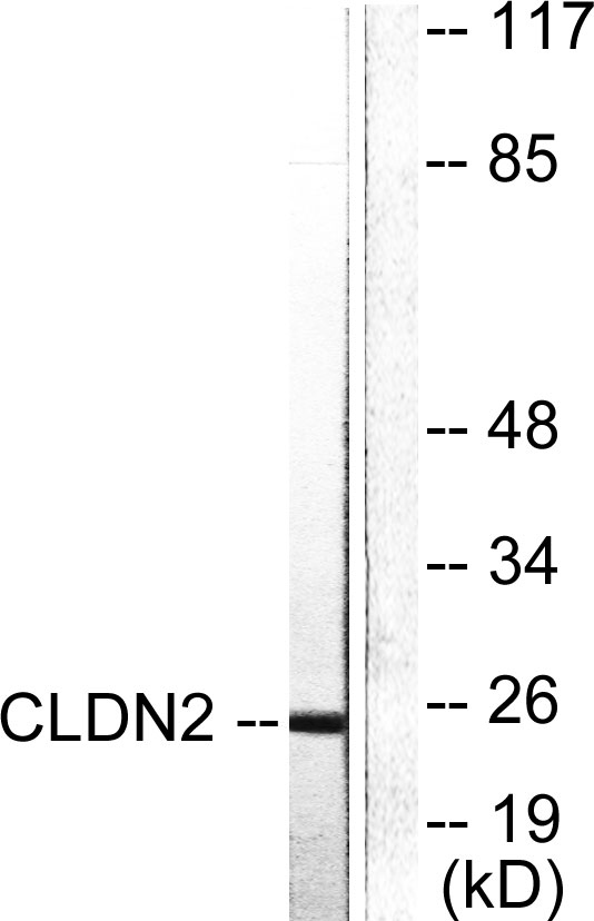 Claudin-2 Rabbit Polyclonal Antibody | 兔多抗 | EnkiLife恩玑生命