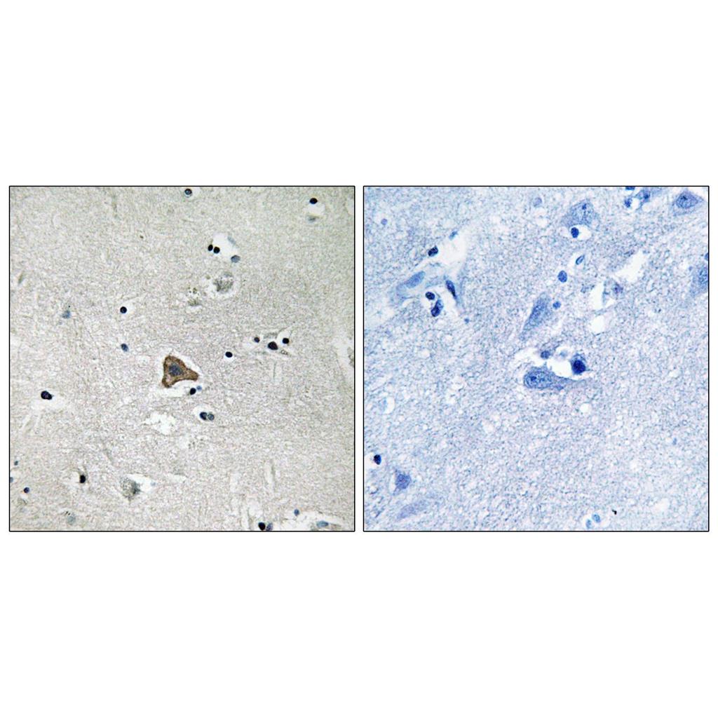 Claudin-4 Rabbit Polyclonal Antibody | 兔多抗 | EnkiLife恩玑生命