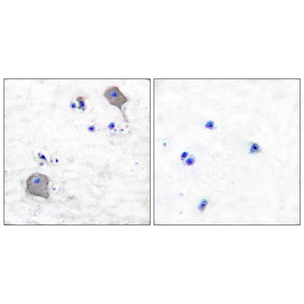 Claudin-5 Rabbit Polyclonal Antibody | 兔多抗 | EnkiLife恩玑生命