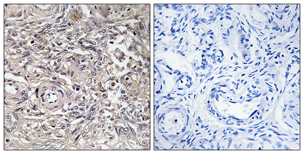 Claudin-6 Rabbit Polyclonal Antibody | 兔多抗 | EnkiLife恩玑生命